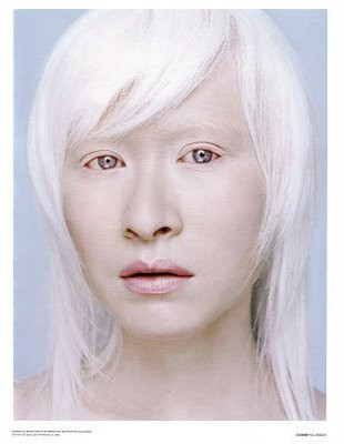 Albino Asian People 42