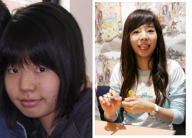 Plastic Surgery